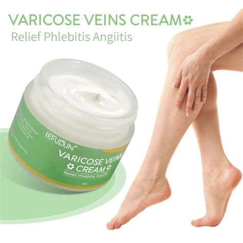 Wholesale Effective Varicocele Treatment Relief Soothing Ointment