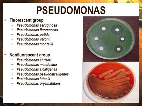 Pseudomonas Putida Colony Morphology