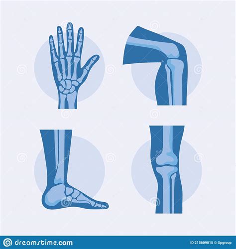Rheumatology Bones Icons Stock Vector Illustration Of Feet 215609015