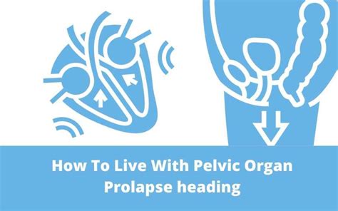 How To Live With Pelvic Organ Prolapse