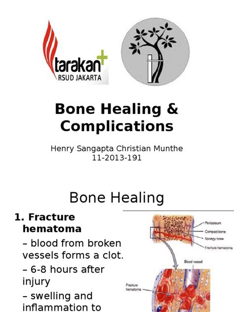 Bone Healingppt Healing Bone
