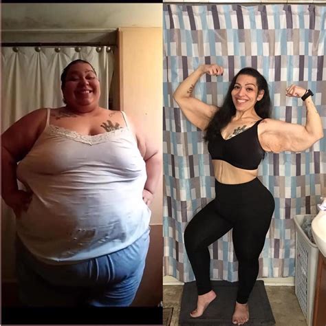 500 Pound Woman Had To Lose 300 Pounds Or Suffer Pain For Rest Of Her