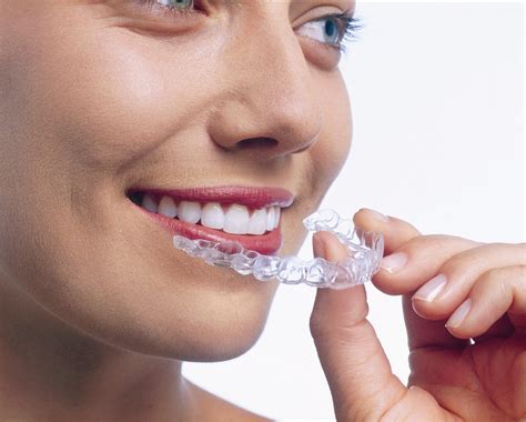 What Are The Types Of Braces For Straightening Teeth Nutritional