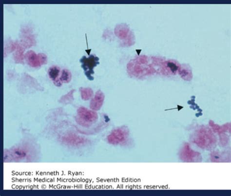 Gram Positive Cocci Flashcards Quizlet