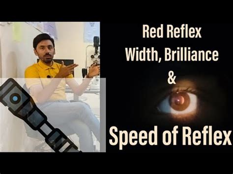 Red And Ret Reflex In Retinoscopy YouTube