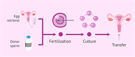 What Is Ivf Treatment And How Does It Work