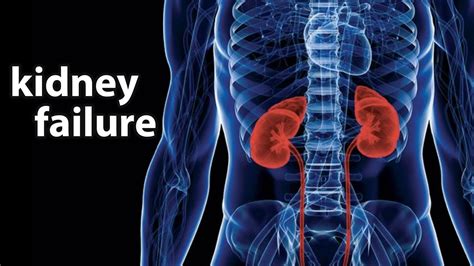 Kidney Failure Causes Symptoms Diet And Treatment