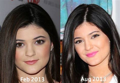 Like i've said before, it has. Kylie Jenner Plastic Surgery Before and After Eyebrows