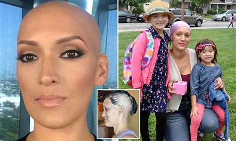 Bald Mother Inspiring Her Daughters Daily Mail Online
