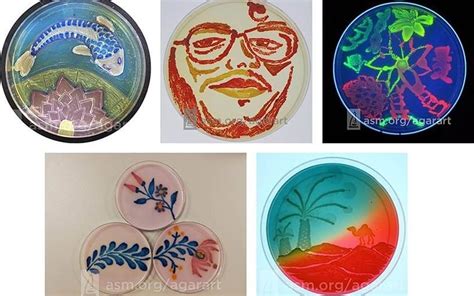 Award Winning Agar Art Beautiful Microbiology Know Pathology Know