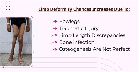 Limb Deformity Correction Treatment In Ludhiana Punjab Limb