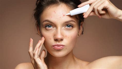 5 Common Skincare Mistakes That Could Be Causing Your Acne Oh Beauty