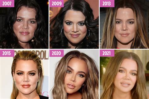 Khloe Kardashians Ever Changing Face As She Blasts Trolls For