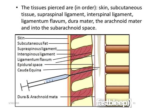 Lumbar Puncture Anatomy Layers