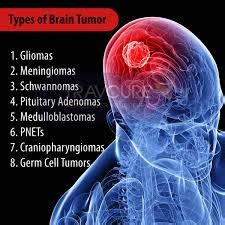 One important way is to do blood and urine tests which measure antibodies and proteins which indicate the because they effect the bone marrow, blood cancers are different than solid tumors like those of the lung, prostate, and breasts. Brain & Spine Tumors - Dr Prem Pillay