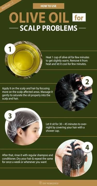 10 Best Home Remedies For Dry Scalp And Prevention Tips Artofit