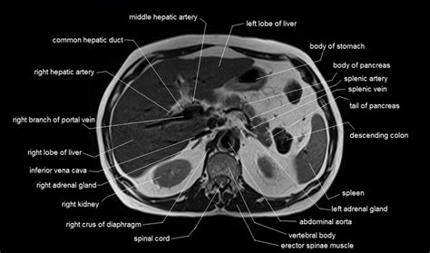 Abdominal Mri Anatomy