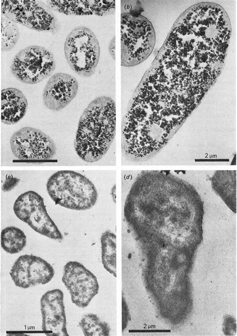 Electron Micrographs Of B Fragilis Subsp Fragilis Bb A B Cells