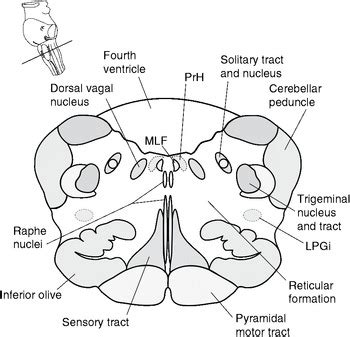 Brainstem nuclei involved in the control of mandibular movements in rats. Bookbrain Stem Nuclei : Brainstem Rules Of 4 Litfl ...