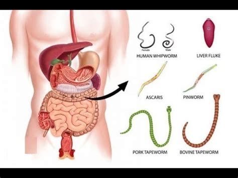 Lice are species specific, meaning you can't pass them to your cats and vice versa. How to Get Rid of Worms in Humans: 5 Simple Home Remedies ...