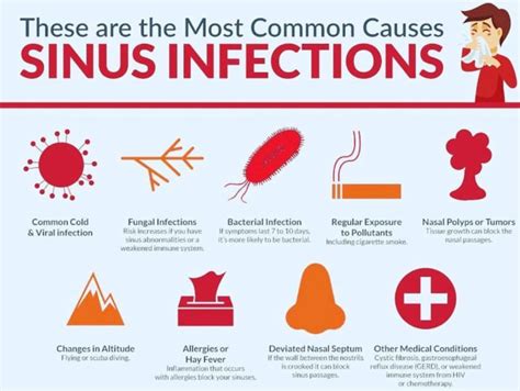 What Is Sinusitis Vitality Health Plus