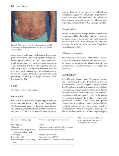 Medicine By Sfakianakis G Alexandros Skin Disease In