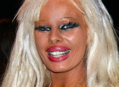 These Examples Of Plastic Surgery Gone Horribly Wrong Will Haunt