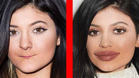 Celebrities Before And After Plastic Surgery