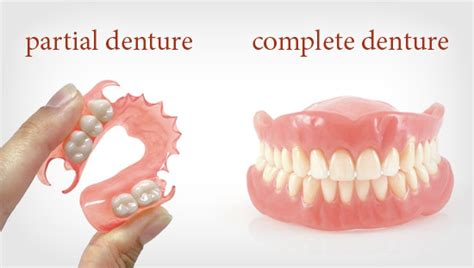 Complete And Partial Dentures In Thornhill