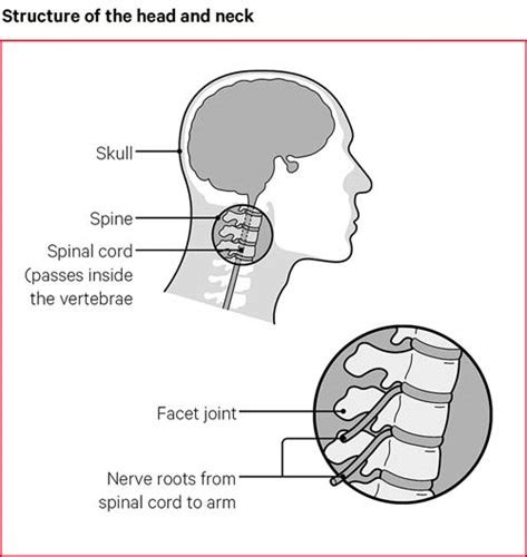 Neck Pain And Headaches In Back Of Head Pin On Massage That Means