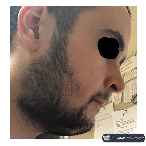 Aye, didn't really start growing until i was 17/18. 4 weeks without shaving, do u guys think i should keep ...