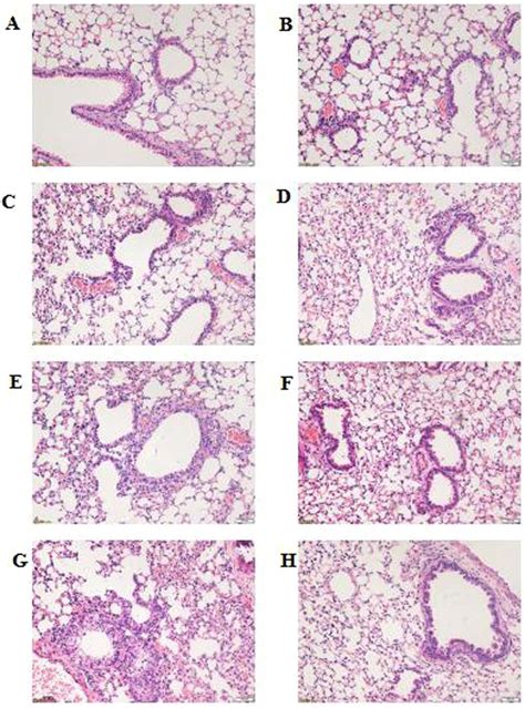 Histopathological Changes In Lung Tissues Histological Changes Were