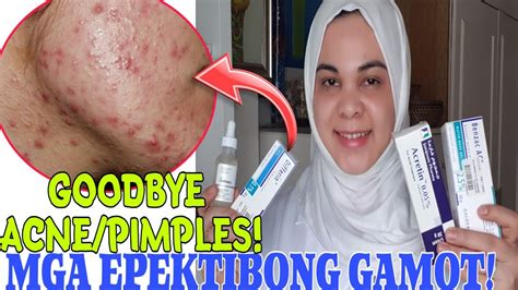 Tamang Pag Gamit Ng Mga Gamot Sa Acne Pimples Youtube