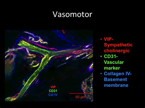 Dysautonomia International Research Grant Vasomotor Neuropathy In Pots