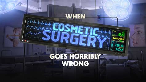 When Cosmetic Surgery Goes Horribly Wrong Simon Withington