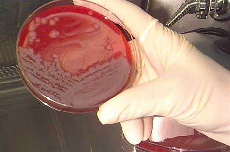 Cultura Bacteriana Colônias De Bactérias Microbiologia Infoescola