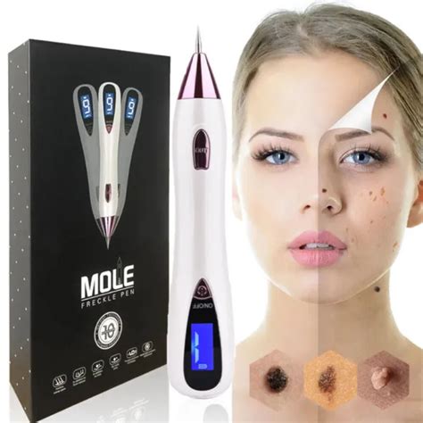 Electric Laser Skin Tag Freckle Wart Mole Remove Pen Dark Spot Tattoo