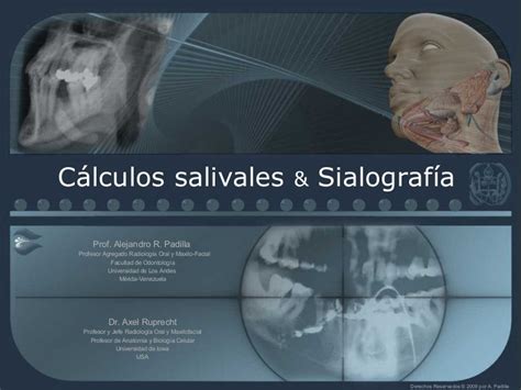 Estudio RadiogrÁfico De Los Calculos Salivales SialografÍa
