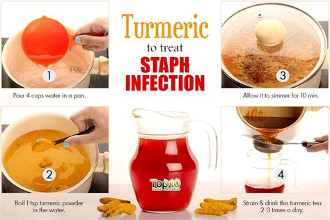 People who keep getting these types of infections must take steps to eliminate the staph bacteria that is colonizing their skin. Home Remedies for Staph Infection | Top 10 Home Remedies