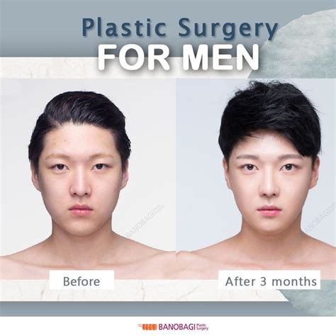 Plastic Surgery For Men 2020