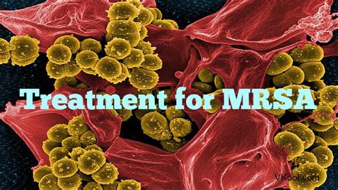 While mrsa typically causes a skin infection, other infections may occur from exposure to mrsa, such as pneumonia and blood. Treatment for MRSA infection at home