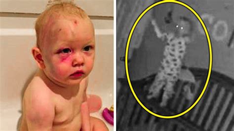 A Mother Put A Hidden Camera Because Her Son Wakes Up With Bruises