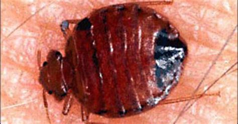 Dont Let The Bedbugs Bite You Cbs News