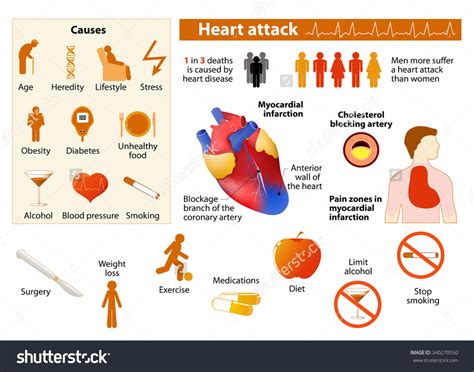 • the most common etiology is rheumatic heart disease. Chronic Diseases - Saratoga County New York
