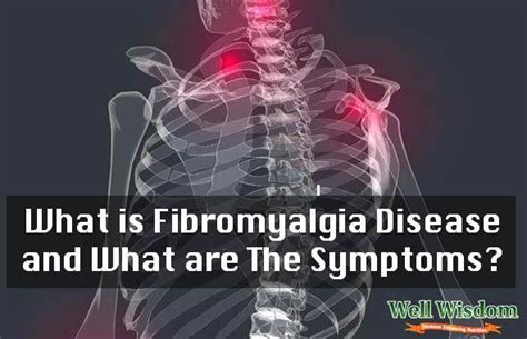 What Is Fibromyalgia Disease And What Are The Symptoms
