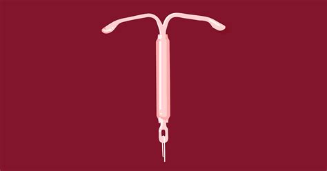 Mirena Iud Removal Female Contraceptive Personal Story