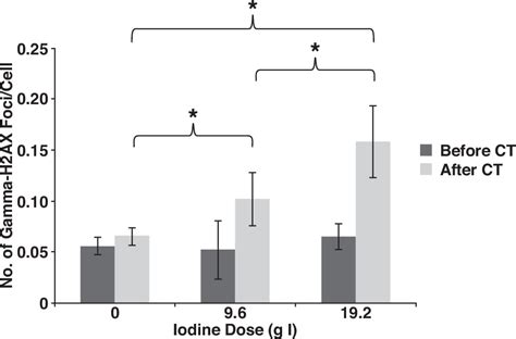 Iodine Dose Of Administered Contrast Media Affects The Level Of