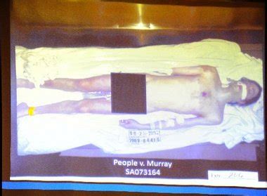 Jurors Shown Shocking Michael Jackson Autopsy Photos Nj Com