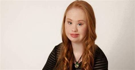 Aspiring Teen Model With Down Syndrome Hopes To Redefine Beauty