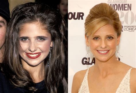 He didn't get a chance to go over and kiss her. Sarah Michelle Gellar Nose Job